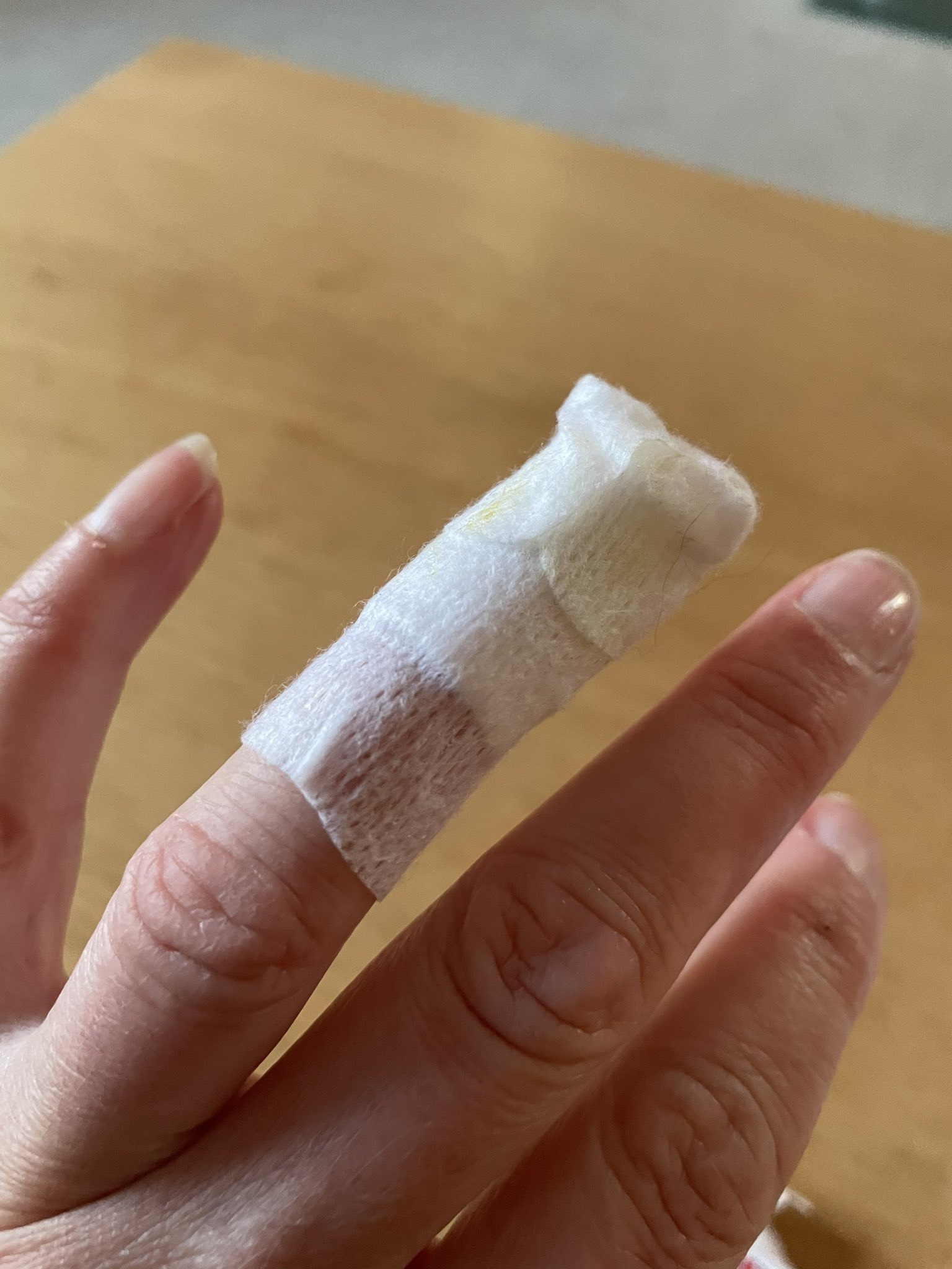 Alison Hernandez\s bandaged finger (Image: Alison Hernandez/Twitter - free for use by LDRS partners)