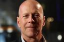 Bruce Willis will retire from acting after being diagnosed wth aphasia (PA)